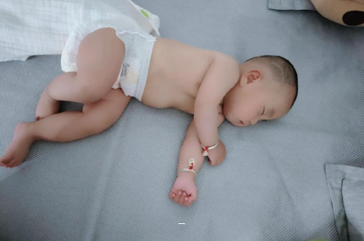 阿勒泰宝宝脸上有白色斑块 阿勒泰宝宝脸上有白色斑块